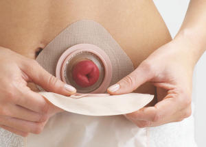 Torbanın Takılması